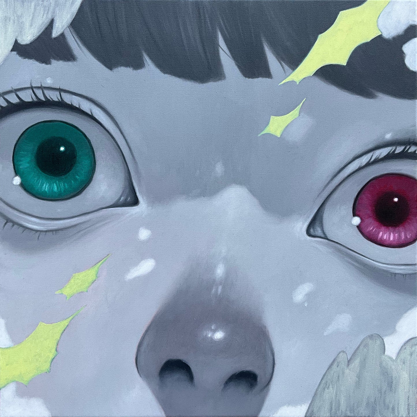 Heterochromia